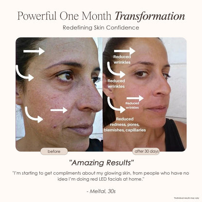 LightAura | LED Face Mask