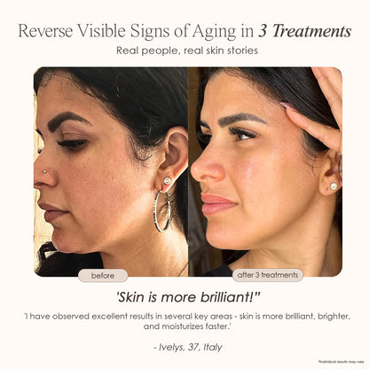 REVA | Instant Age Renewal Wand