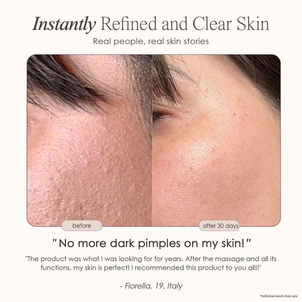 Reinvo | Facial Microdermabrasion Wand