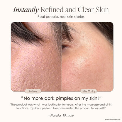 Reinvo | Facial Microdermabrasion Wand