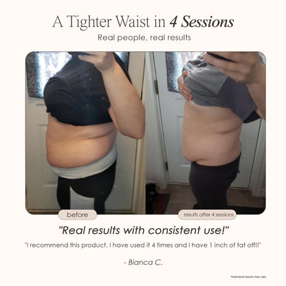 BodySculpt | LED RF Beauty System