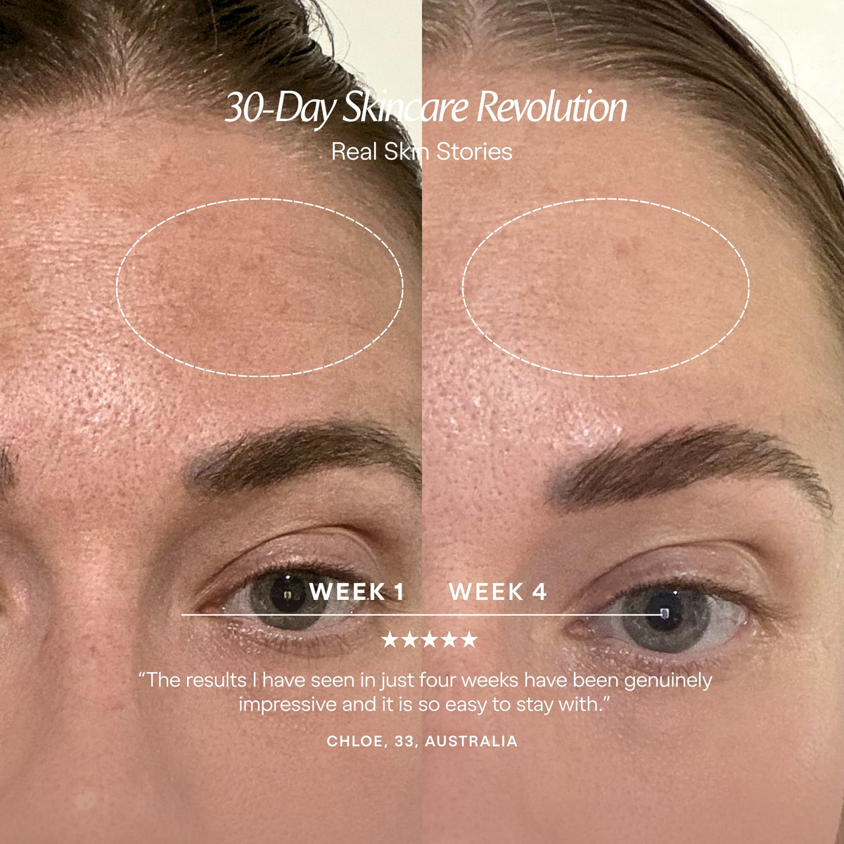 Alora | Age Renewal LED Light Therapy Panel