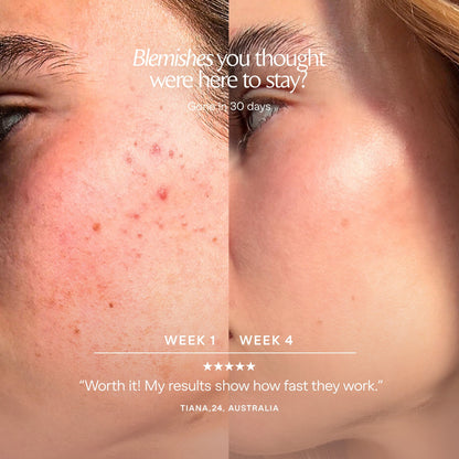 LumaLux Dome | Face & Body LED Red Light Therapy Device